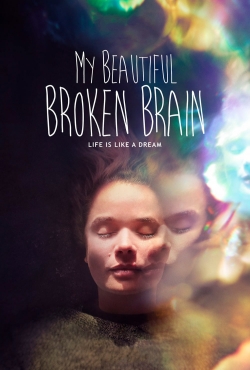 My Beautiful Broken Brain-full